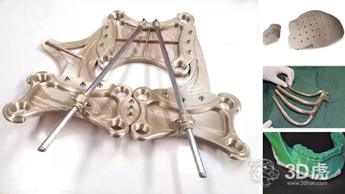 【探討】FDM 3D打印到底有沒(méi)有應(yīng)用性?(圖2) 【探討】FDM 3D打印到底有沒(méi)有應(yīng)用性?(圖2)