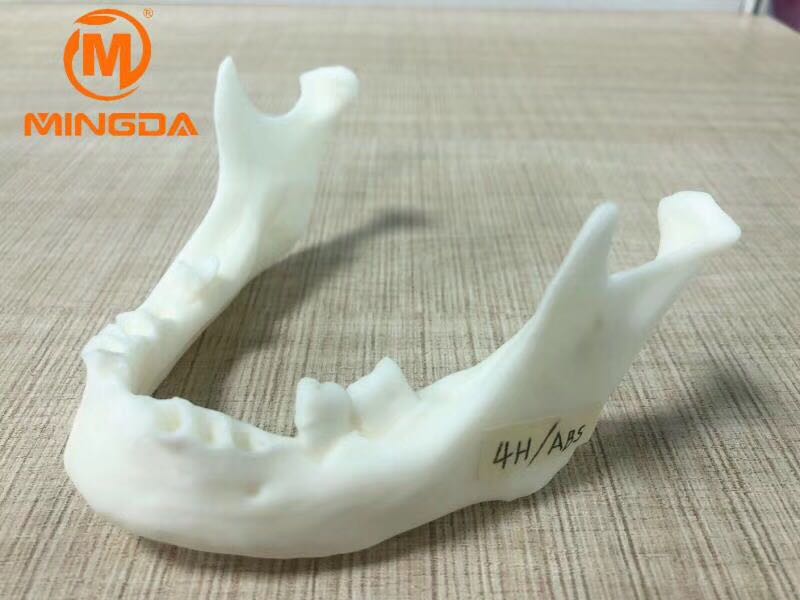 工業(yè)級(jí)3D打印機(jī)在牙科行業(yè)的應(yīng)用(圖1) 工業(yè)級(jí)3D打印機(jī)在牙科行業(yè)的應(yīng)用(圖1)
