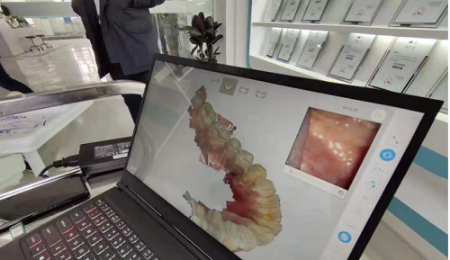  3D打印技術在牙科義齒領域中牙套制作的應用是怎樣的呢？(圖2)